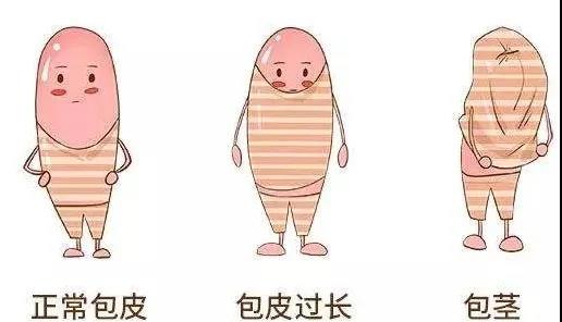 【保山安利醫(yī)院】家長(zhǎng)速看！暑期包皮手術(shù)預(yù)約正當(dāng)時(shí)！