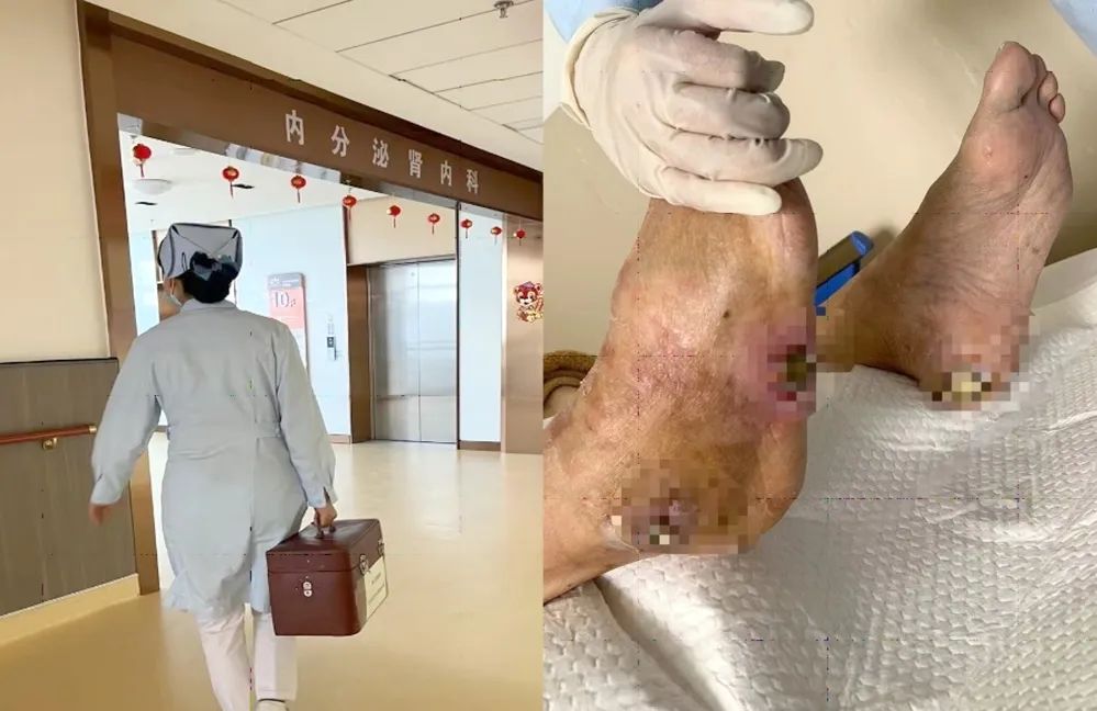【保山安利醫(yī)院】傷口治療一站式，健康生活零距離！